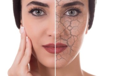 5 Tips for Eliminating Fine Lines